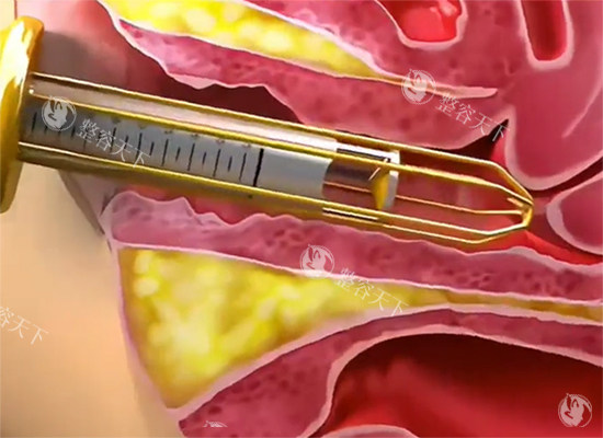 安徽女性医院做私密整形价格是多少？合肥、芜湖等城市医院价格汇总