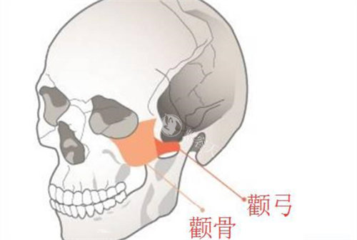 重庆刘正茂医生颧骨失败辟谣：个性化设计颧骨内推价格3w起