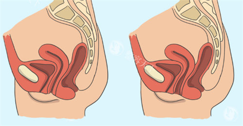 想在云南做私密整形？先看云南女性医院做私密整形价格表，含术前检查费用
