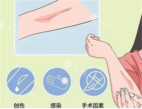 全盘解密!上海健桥医院治疗疤痕价格表揭晓,来看上海建桥疤痕修复中心费用高吗?