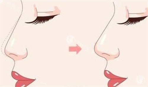 唐山释妍医疗美容整形怎么样?分享简介介绍+地址路线+擅长项目!