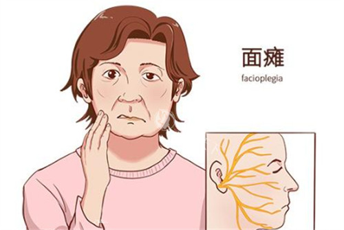 王成元医生工作室：北京治疗面瘫无后遗症，打假声明：抖音上王成元挂号非真实