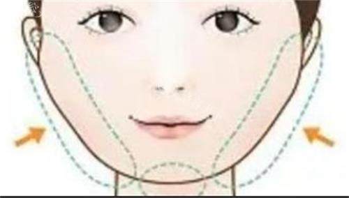 朱乐林磨骨三件套多少钱？拒绝蛇精脸！朱乐林分层截骨法解析：三件套6.8万起自然上镜风值不值！