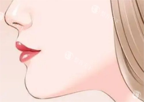 深圳下巴整形医院哪家口碑好?种草这三家:满意度95%左右+3D比较准技术+超万术例实测!