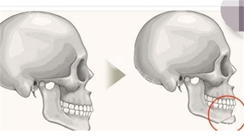 深圳下巴整形医院哪家口碑好?种草这三家:满意度95%左右+3D比较准技术+超万术例实测!