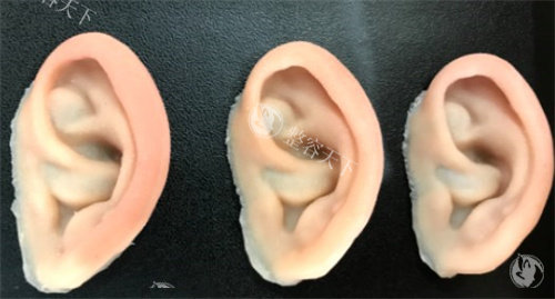 硅胶假耳朵要多少钱全攻略:从通用款几十元到3D/5D万元以上,价格区间分享!