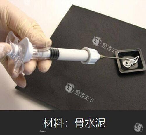 骨水泥材料实物展示图