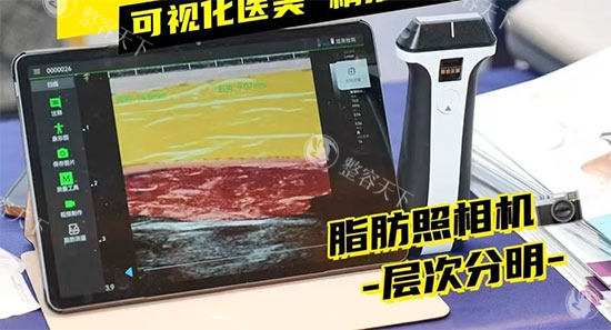 维密金雕实物设备图片