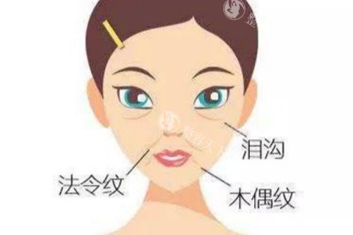 脸上皱纹卡通图片