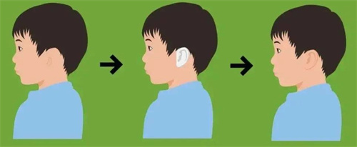 小耳畸形修复指南：上海东方丽人/成都八大处等头部医院测评，收藏这篇就够了！