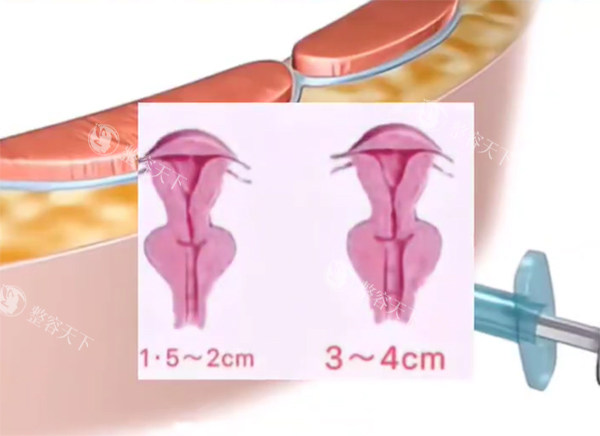 紧缩针对比动画结果