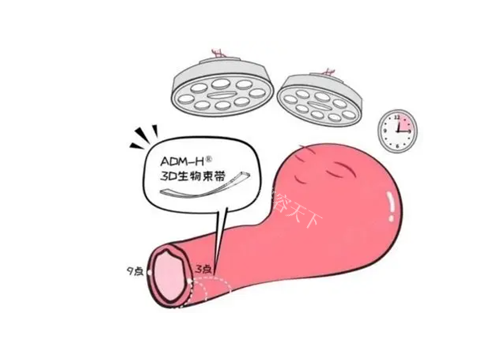 3d生物束带缩阴