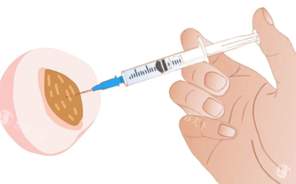 南京紧缩针在哪里预约？我来教你！线上询问-挂号预约-医院名单查询-价格了解都在这里