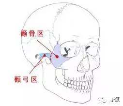 颧骨骨骼图