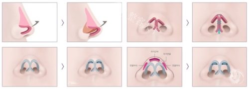 重庆长城骨科医院杨健医生:鼻修复界的“宝藏医生”你了解吗?资质深厚/学术成就斐然|鼻整形造诣高