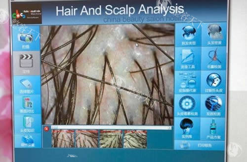 毛囊检测细节图