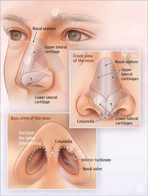 成都鼻修复宝藏医生大揭秘！这家鼻子整形专科医院的技术派团队太圈粉了