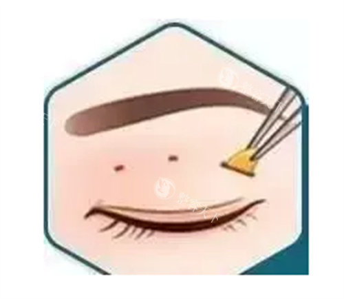 兰州维多丽亚整形走廊环境图