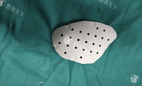 上海peek鼻基底医生谁做好对比实录:何晋龙创新颌面黄金比例算法|Peek骨雕拒绝假面感