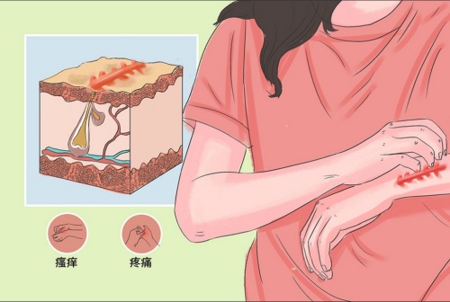 上海健桥医院是正规医院吗？上海健桥医院是可靠的私立正规医院治疗疤痕十分出色_医院资质证明_疤痕治疗技术介绍_患者治疗结果