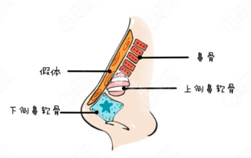 隆鼻动画解剖图