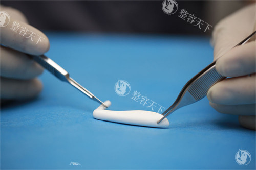 隆鼻手术中使用的膨体