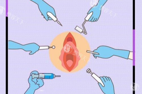 私密整形卡通图