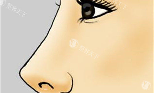 上海岳伟医生口碑评价如何？都说他做吸脂、骨雕鼻注射很不错