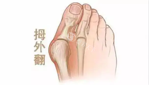 大脚骨示意图