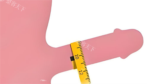 男性增大增粗手术