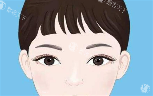 双眼皮展示