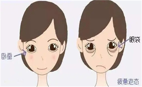 南京朱晓波做卧蚕好在哪？揭晓朱晓波三大核心优势，解决对比传统手术的僵硬/粘连/流水线设计