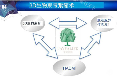 3d生物束带紧缩术讲解示意图