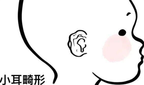 耳朵医生24小时免费问诊，一对一回复有关耳朵整形手术项目费用等