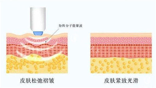 紧致肌肤结果对比