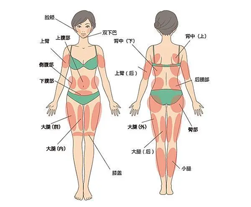 成都2025吸脂手术费用一览：面部吸脂|腰腹|手臂|臀部|小腿等各部位吸脂价格