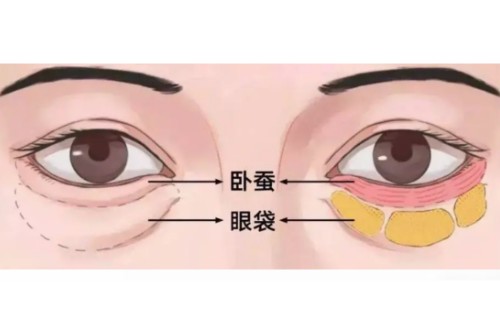 南京朱晓波医生该怎么预约挂号？流程详细解读，包含做卧蚕价格与坐诊医院信息