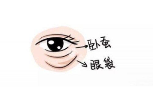 卧蚕、眼袋区别图