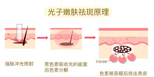 邯郸卫校附属医院皮肤科怎么样？是正规皮肤科！疤痕修复/祛斑/祛痣/祛痘技术好！