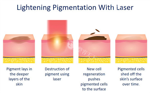 【西京医院皮肤科24小时电话问询】祛斑|祛痘|祛痣|玻尿酸|幼态脸|轮廓固定等轻医美项目都能在线问！