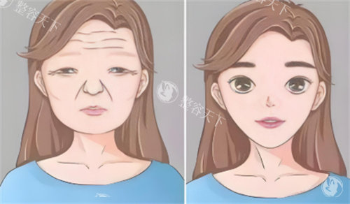 杭州艺星医疗美容医院钟冠鸿院长简介：擅长整体风格微整形_资质正规_支持在线预约询问...