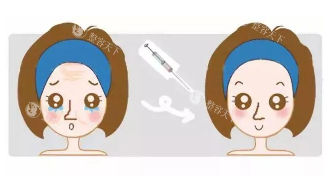 太原时光整形注射技术好吗，院内医生技术娴熟审美好！