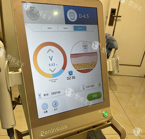 黄金超声炮