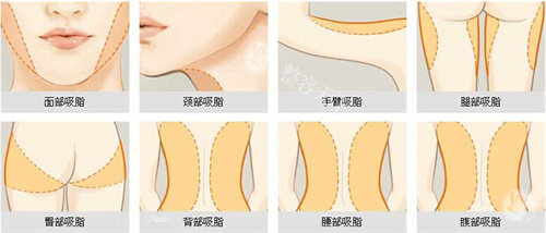 可以进行吸脂手术的部位展示动画图