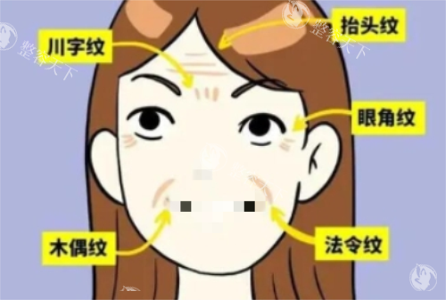 面部皱纹详细示意图