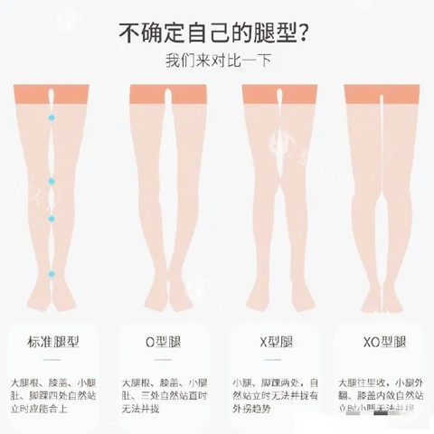 腿型矫正图