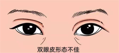 杭州双眼皮医生排名：杨连华/欧阳帆/陈笑/黄良飞/赵国录/徐丹这几位技术口碑双在线的医生！