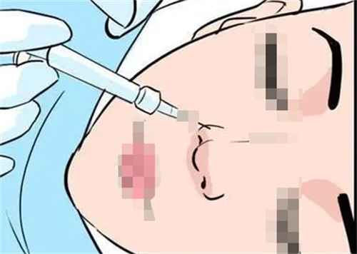 少女针和童颜针到底有什么区别？一篇看懂哪种更适合你，别再被忽悠了！