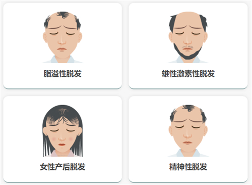 丽江正规植发医院价格多少钱？碧莲盛 8000 元起、吴氏嘉美 9 元 / 单位起，多医院多技术价格汇总