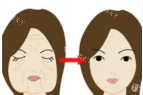 张路面部提升三件套不坑钱：含术前评估+术后护理，性价比高！